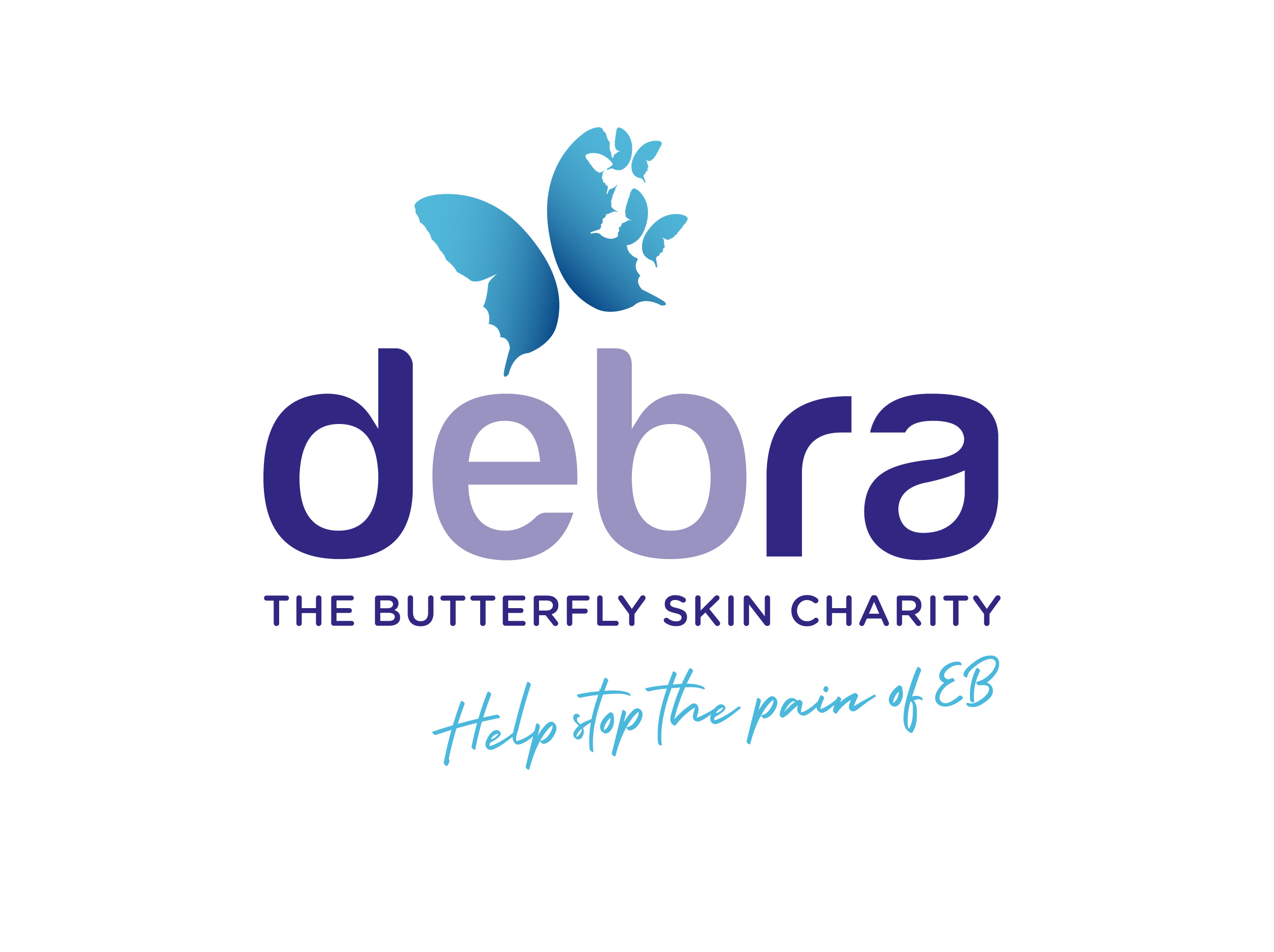 Debra UK